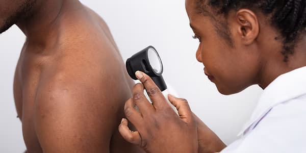 IA et dermatologie en contexte à ressources limitées